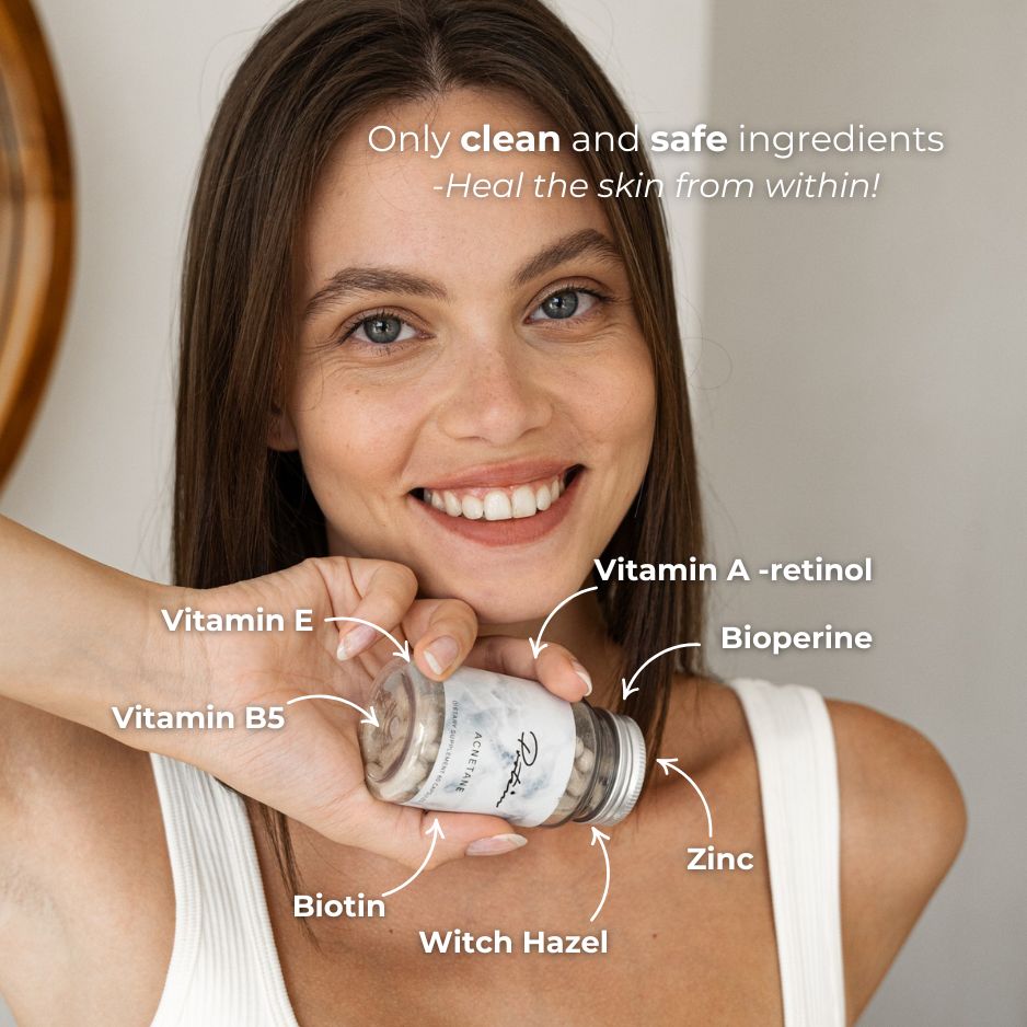 Acnetane | Get rid of stubborn Acne | 60 Capsules